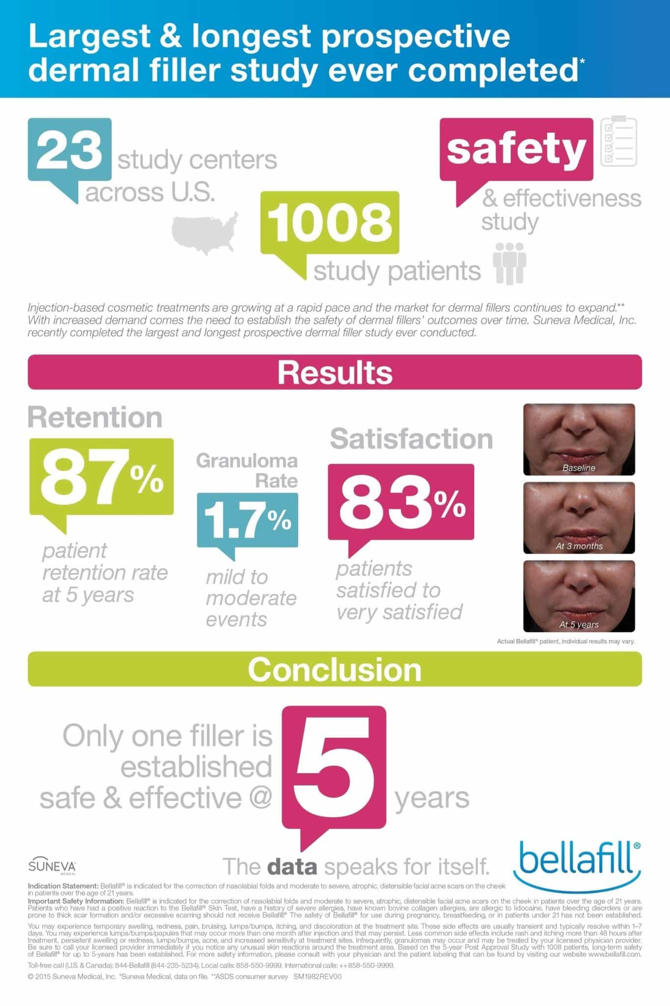 Bellafill is the first and only FDA approved dermal filler indicated for the correction of nasolabial folds that has been established as safe and effective through five years with high patient satisfaction (PRNewsFoto/Suneva Medical, Inc.)