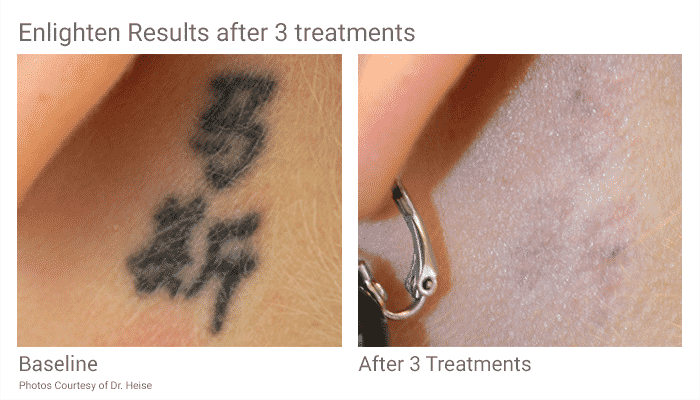 pico tattoos tattoo collections pico tattoos tattoo collections