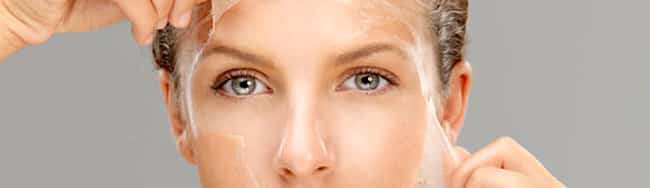 chemical-peel-