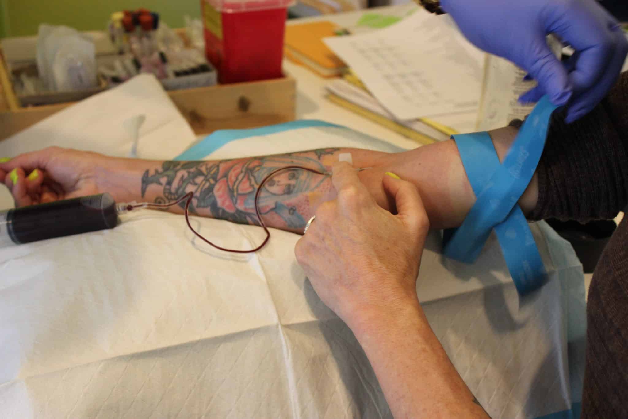 Drawing Blood for the platelet Rich Plasma procedure (PRP) in Seattle at Well Medical Arts.