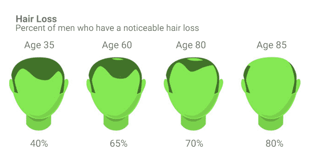 HairLossGraph_2